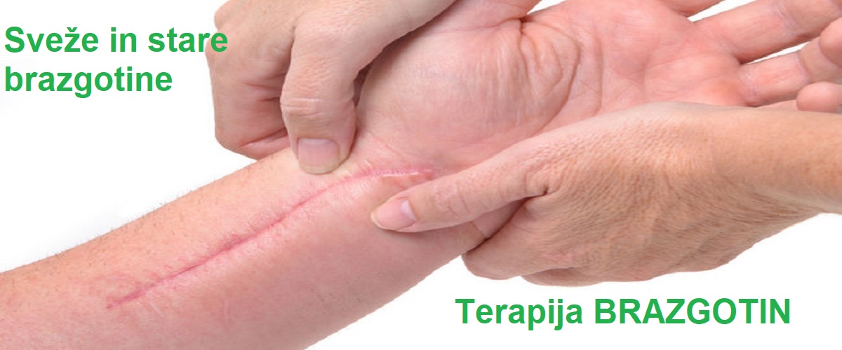 Terapija brazgotin sveže in stare