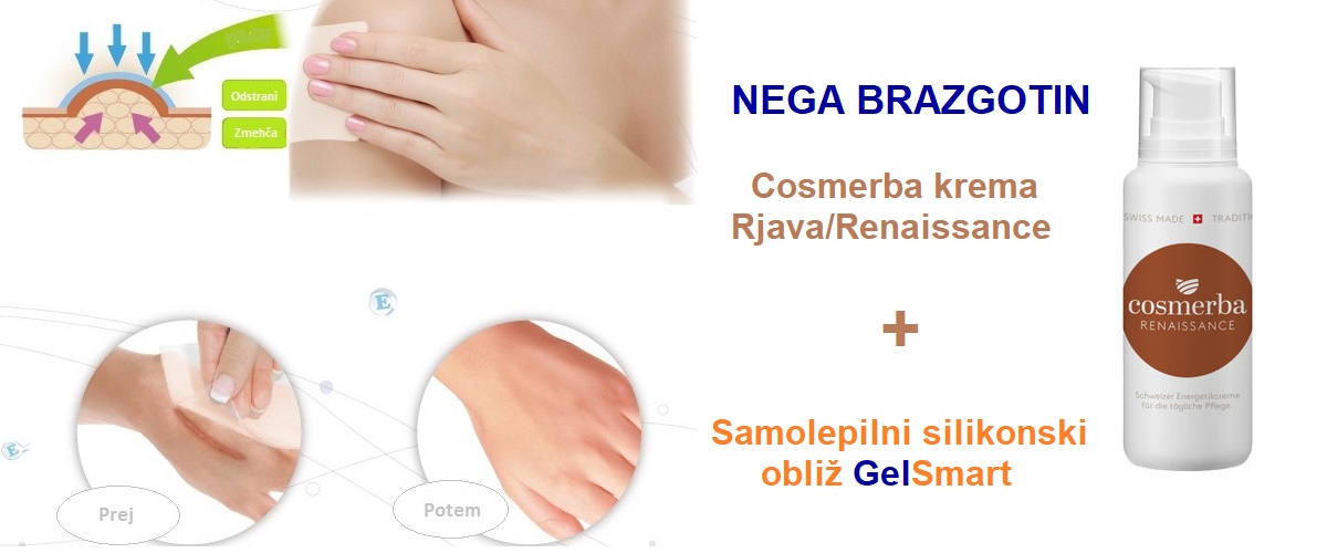 BRAZGOTINE